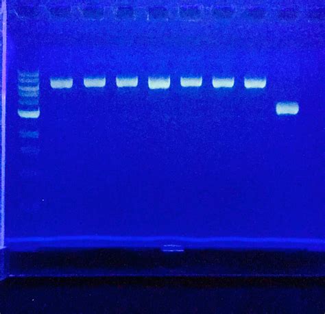 8: Agarose gel electrophoresis .